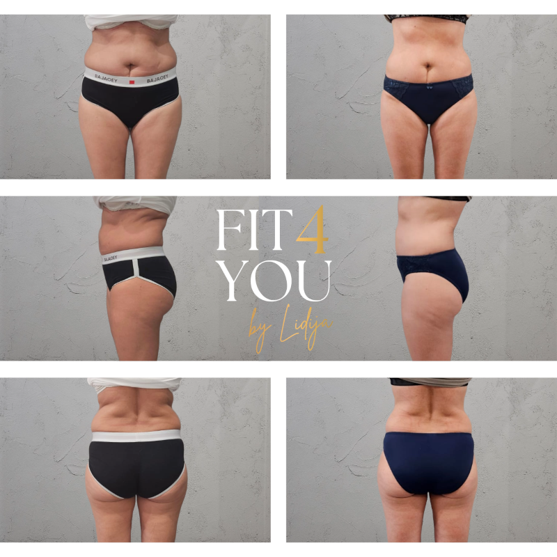 Vorher-Nachher Ergebnis – Figurformung FIT4YOU by Lidija